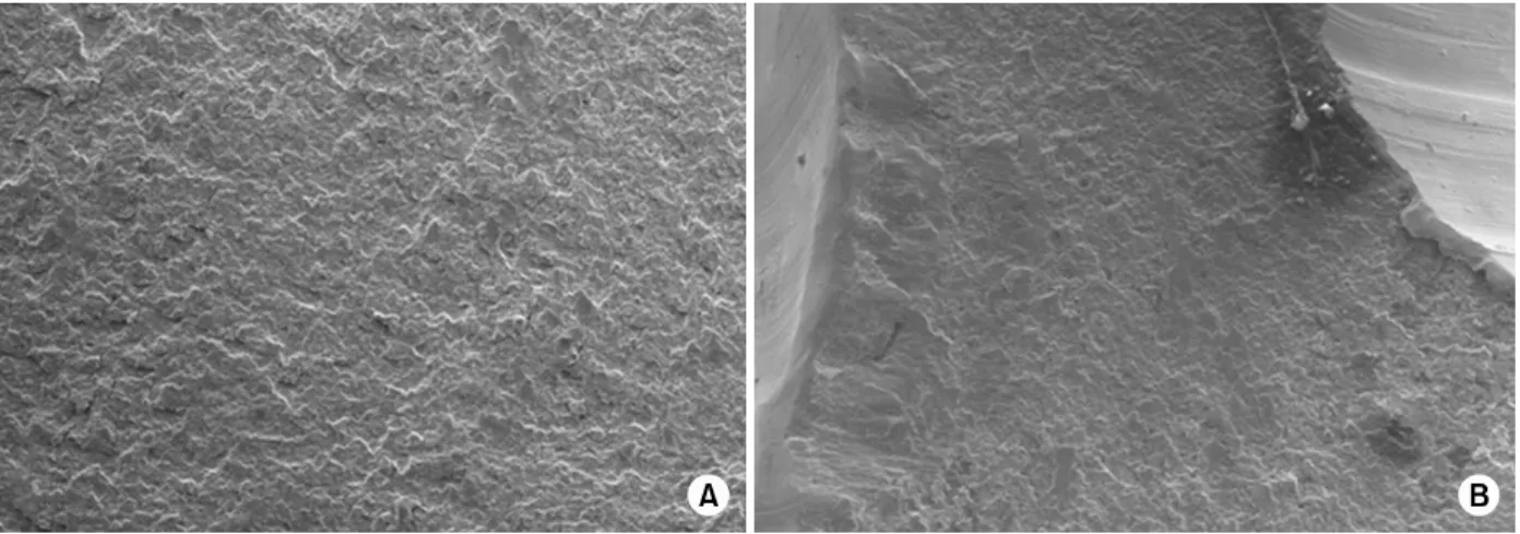 Fig. 9. Scanning electron microscopic study (SEM) showed the implant horizontal fracture surface in the Case 2 patient