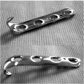 Fig. 1. Close up photograph of modified spring plate. A  newly designed spring plate which is made from ordinary  one third tubular plate; The distal hole of the plate was  cutting and sharpened by rasp