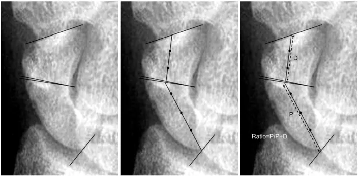 Fig. 1. Fragment ratio. Horizontal lines were drawn to define the extent of the fragment