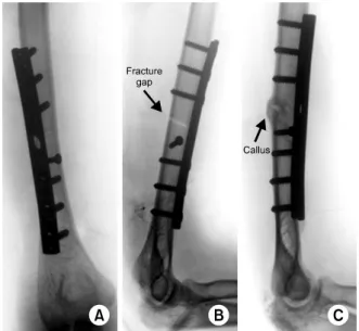 Fig. 1. Bone fracture augmentations with compressing plate  (A), the arrow indicates the fracture gap at the bone fracture  site  (B), and the arrow indicates callus formation around the  bone fracture site (C)