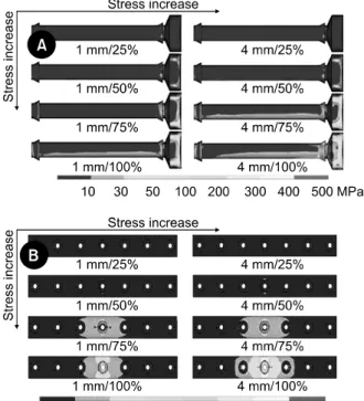 Fig. 3. Von Mises stress distributions and levels on the  screws  (A) and the plates (B) according to the changes of  the fracture gap size and fracture gap width under  compressive load.