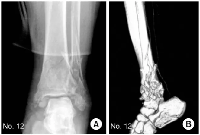 Fig. 2. Case 12. 
