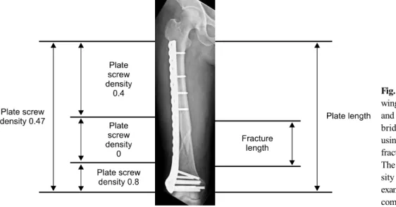 Fig. 9. The schematic dra- dra-wing shodra-wing the plate length  and plate screw density in a  bridging plating technique  using LCP in a comminuted  fracture of the distal femur