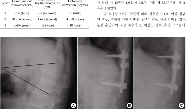 Fig. 1. T12 bursting fracture with severe kyphosis. 