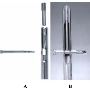Fig. 1A. Proximal part of  Interlocking-Compression (IC) nail composed of  locking holes, screw and a compression screw