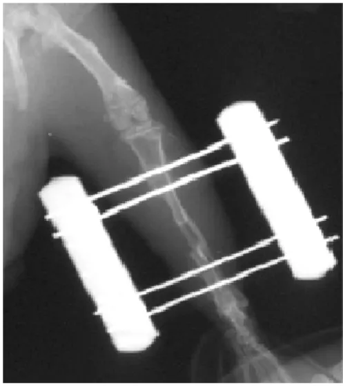 Fig. 3. Anteroposterior view of  radiograph showing scanty callus formation only at the medial cortex of  the tibia and no hypertrophy of  the fibula 8 weeks after surgery in control group 