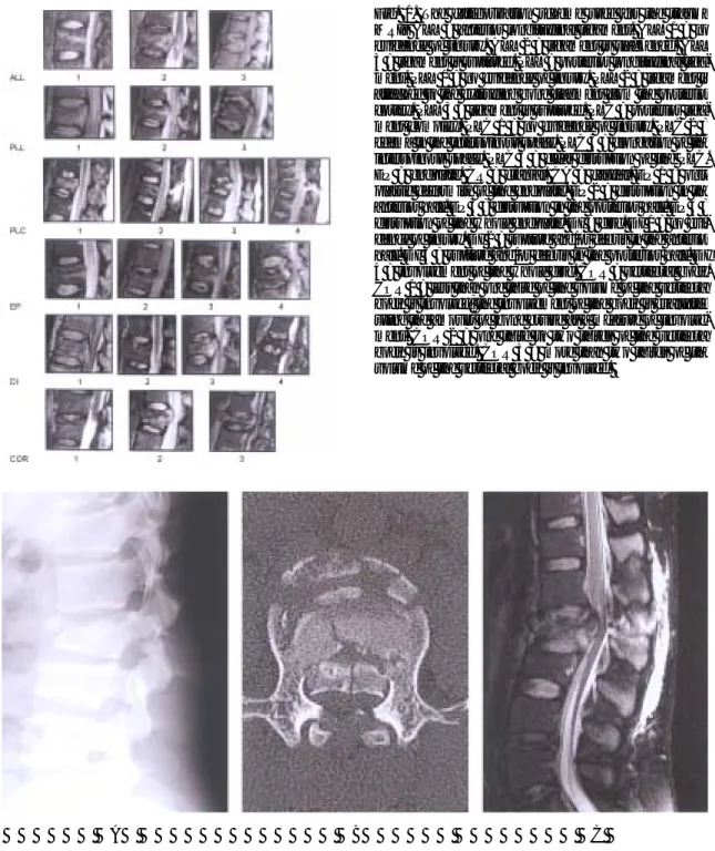 Fig. 1. The categorization scheme used for the trauma MRIs ALL = anterior longitudinal ligament