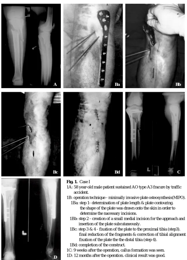 Fig. 1. Case I