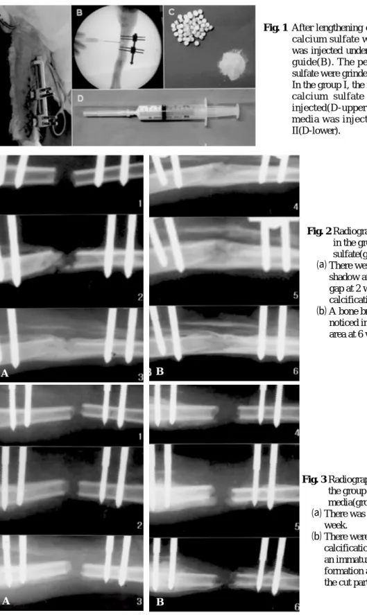 Fig. 1 After lengthening of rabbit tibia(A), calcium sulfate with CMC media was injected under the fluoroscopic guide(B)