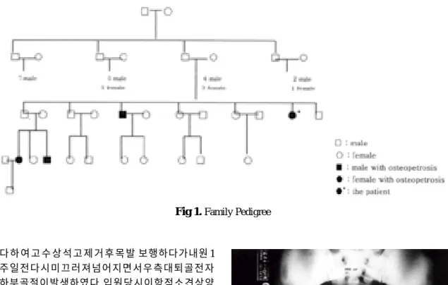 Fig 1. Family Pedigree