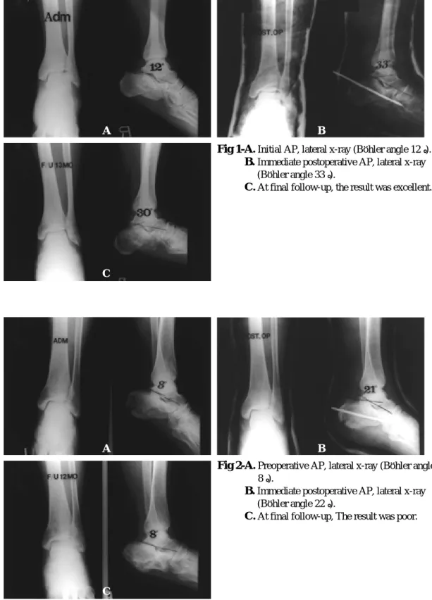 Fig 1-A. Initial AP, lateral x-ray (B .. ohler angle 12°).