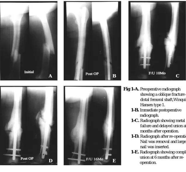 Fig 1-B. Immediate postoperative radiograph.