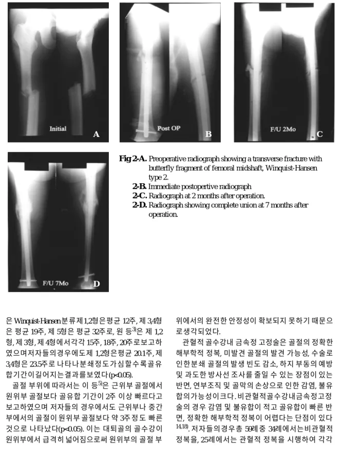 Fig 2-B. Immediate postopertive radiograph Fig 2-C. Radiograph at 2 months after operation.