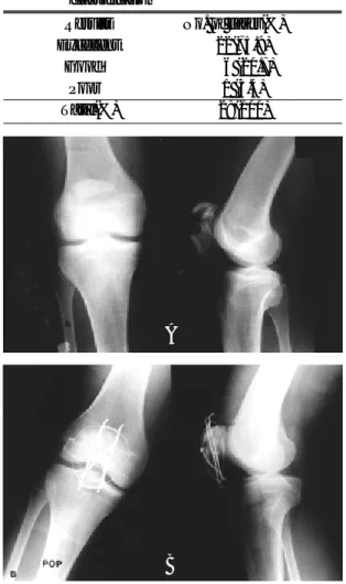 Fig 1-A. Roentgenogram of 39-year-old male with comminuted fracture of the patella