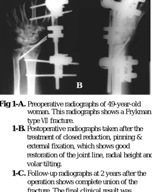 Fig 1-B. Postoperative radiographs taken after the treatment of closed reduction, pinning &amp;