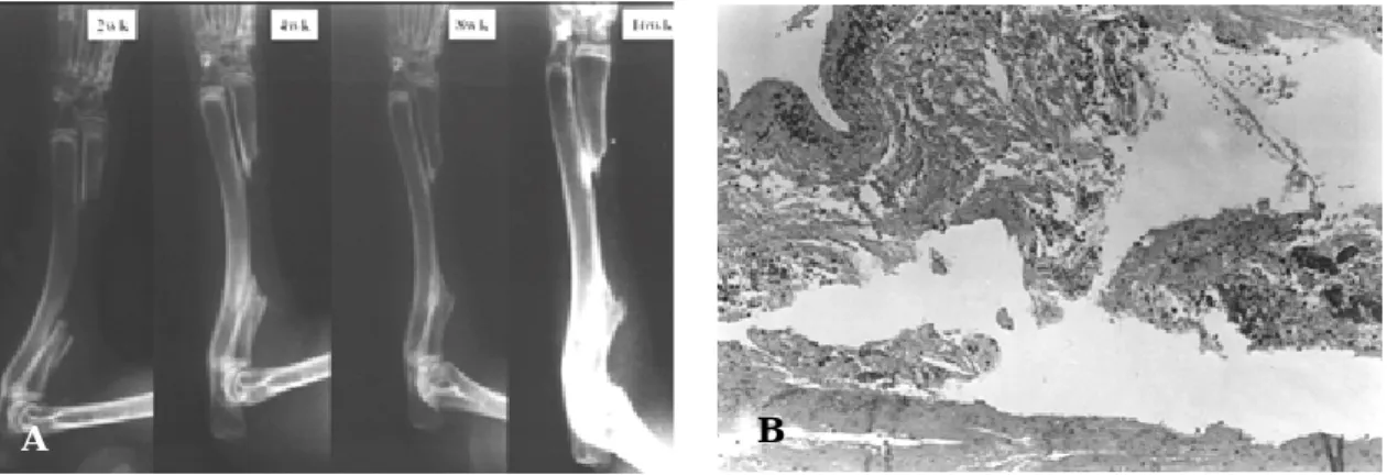 Fig 4. A; Simple roentgenographs showing no evidence of new bone formation at 2, 4, 8, 16th week after operation