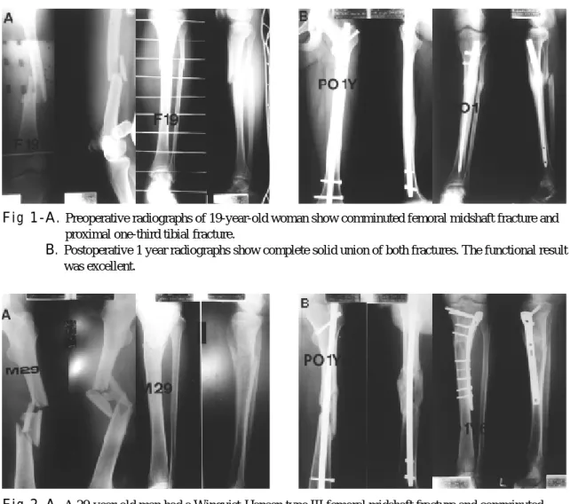 Fig 1- B.  Postoperative 1 year radiographs show complete solid union of both fractures