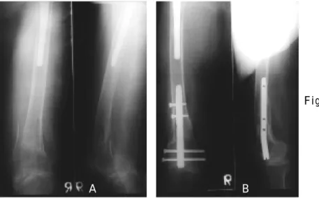 Fig 4-A.  Sixty eight year old woman with