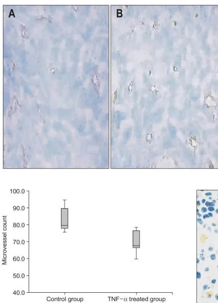 Fig.  3.  Immunohistochemical  stain  with  CD31.  Variable  sized  vessels  are  highlighted  by  endothelial  cell  marker,  CD31