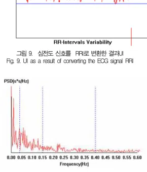 그림 8. 정합필터를 적용하여 측정한 심전도 Fig. 8. ECG measured by applying a matched filter 그림 8은 전송된 심전도 파형을 정합필터를 적용한 파형이 다