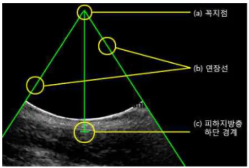 그림 5. 피하지방층 추출 결과 비교 Fig. 5. Comparing Methods in Extracting Subcutaneous Fat Area