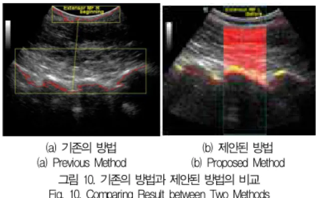 표 1은 요부 초음파 영상에서 제안된 방법을 적용하여 근 육 영역을 추출한 결과에 대해 물리치료사가 분석한 결과를 나타낸 것이다. 표 1에서 알 수 있듯이 본 논문에서 제시한 방법이 요부의 근육 영역을 효과적으로 추출하는 것을 확인할 수 있다