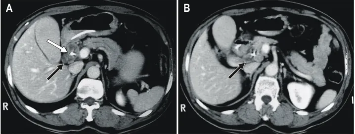 Fig.  1.  Chest  X-ray  finding.  There  is  no  abnormal  finding.