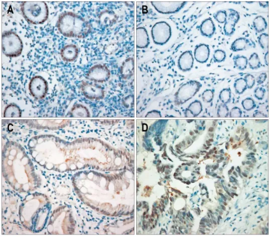 Fig. 1. Immunohistochemical staining of PPARγ expression in various tissues (×400). (A) Strong nuclear staining is  ob-served in foveolar epithelial cells of H