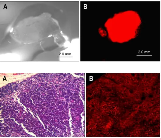 Fig.  2.  A  stereomicroscopic  bright  field  image  (A)  and  red   fluo-rescence  image  (B)  of  excised  lymph  node