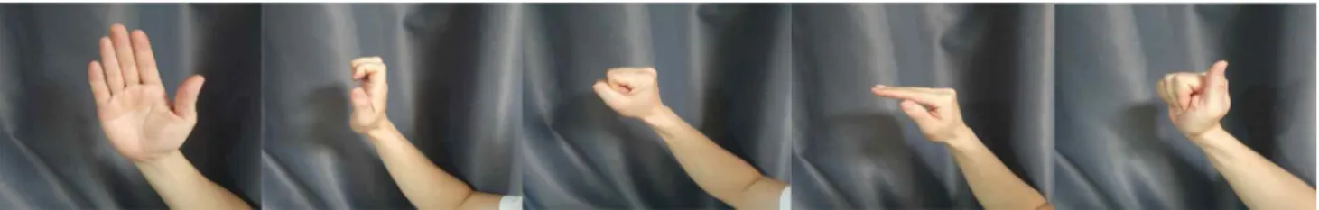 Figure 1-A.  Flexor tendon gliding exercise(flat, hook, punch, table-top, flat-punch)