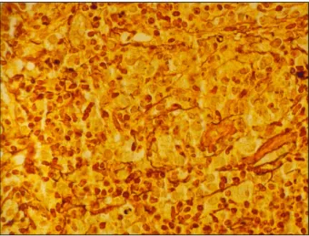Fig.  4.  Microscopic  finding.  There  are  many  Spirochetes  in  the  mucosal  biopsy  specimen  (Warthin  Starry  stain,  ×400).