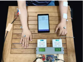 Figure 1.  EMG-triggered functional electrical stimulation  device