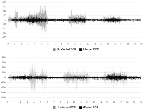 Figure 2.  Muscle activation of unaffected and affected forearm muscle
