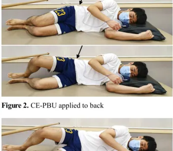 Figure 3.  CE-PBU applied to side