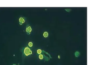 Fig. 1. The fluorescent finding using PEI as gene carrier.