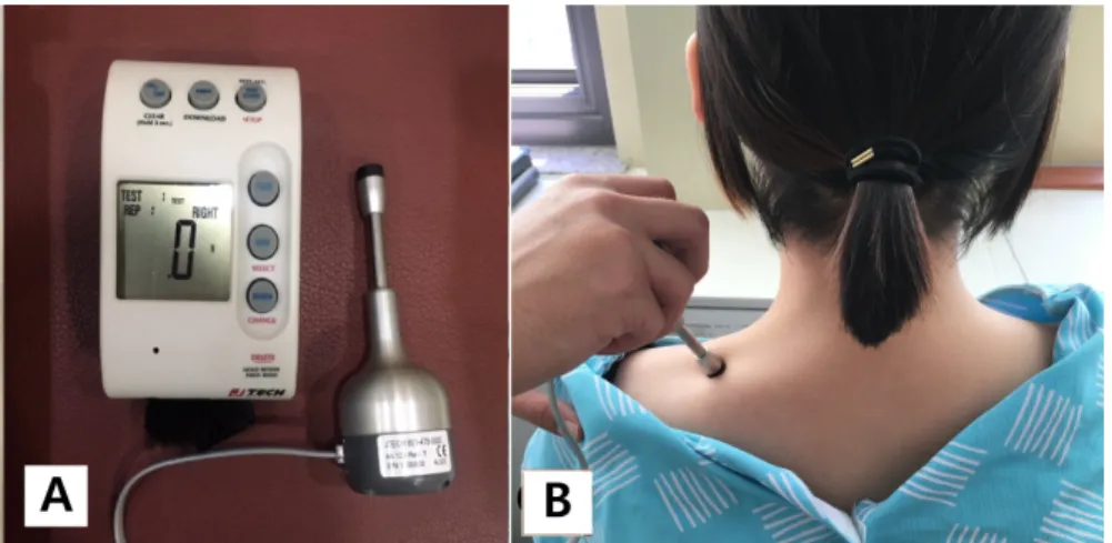 Figure 1. (A) Algometer. (B) Measur- Measur-ed upper trapezius. 