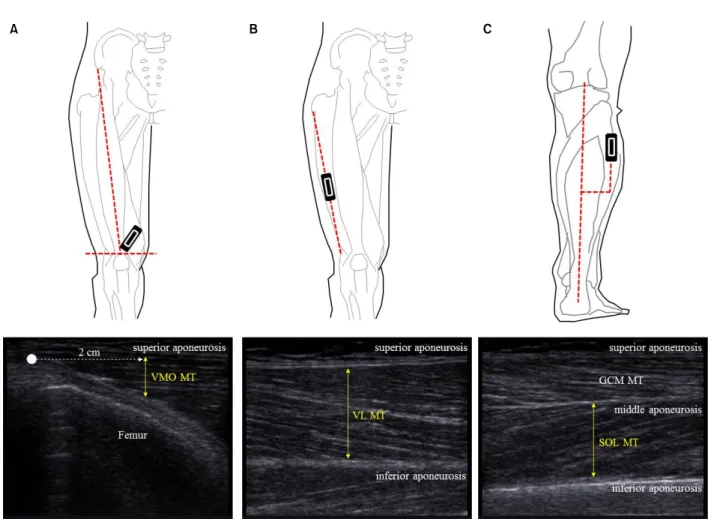 Figure 2. The position of the ultrasound probe and the position of the muscle thickness measurement from the ultrasound image