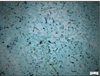 Fig.  3.  Microscopic  finding  of  the  aspiration  specimen.  It  shows  fungal  hyphe  which  is  morphologically  consistent  with  candidiasis  (GMS  stain,  ×200)