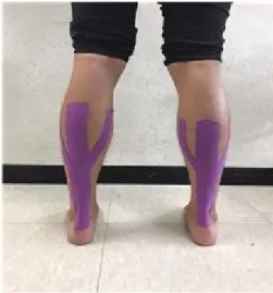 Figure 1. Foam roller intervention. Figure 2. Kinesiotaping intervention.