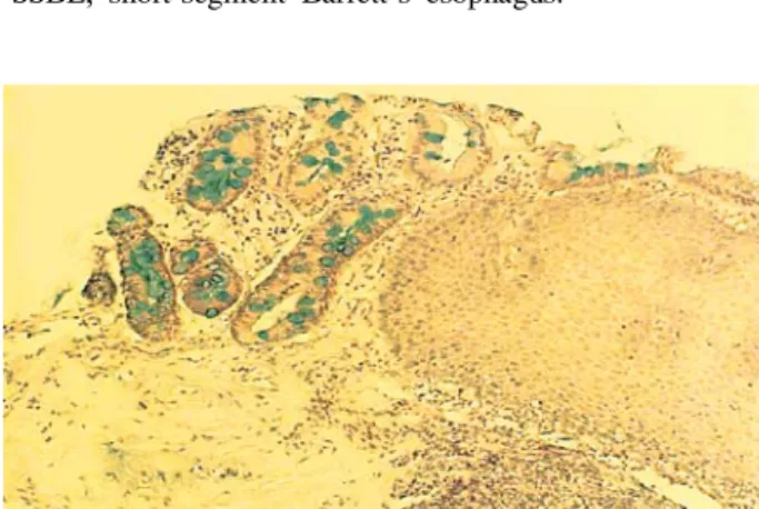 Fig. 1. Alcian blue staining (pH 2.5) of the mucosa of squamo- squamo-columnar junction