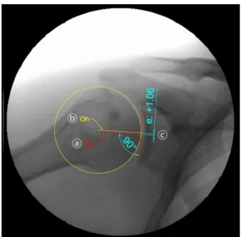 Figure 1. Radiographic analysis. a: axis of the scapula, b: axis of  the humeral head (Oh), c: the e value.