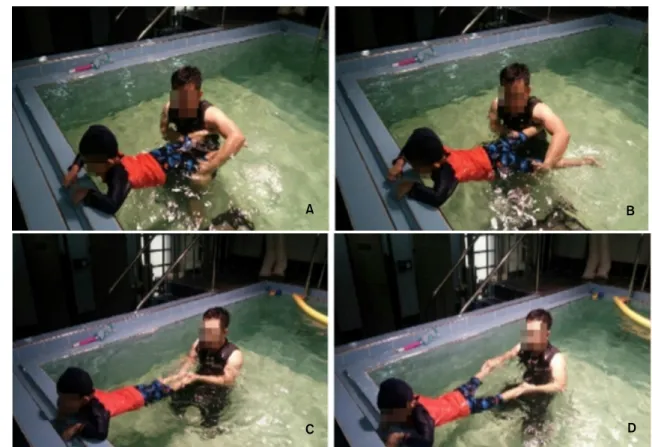 Figure 3. Horizontal adduction and abduction movement of lower limb. (A) Unilateral adduction