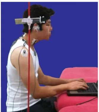 Figure 3. Forward head position.