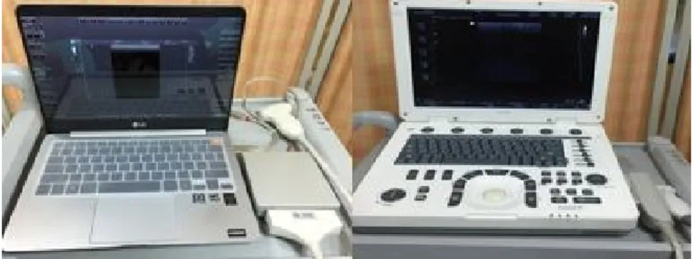 Figure 1. (A) Personal computer-based muscle viewer and (B) portable  ultra-sound.