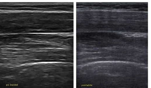 Figure 2.  Resolution the difference  between the two devices. (A) Personal computer-based muscle viewer