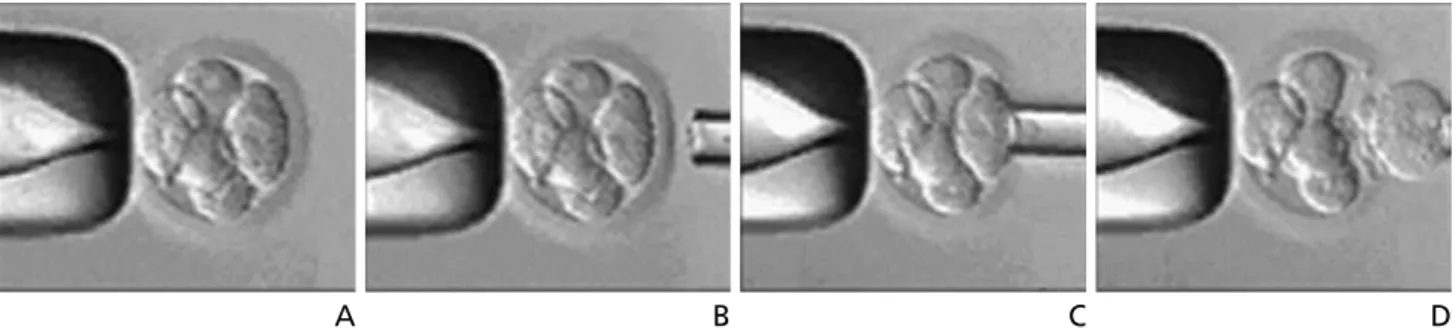 Figure 1.  Blastomere biopsy with acid Tyrode’s solution or laser in cleavage stage embryo