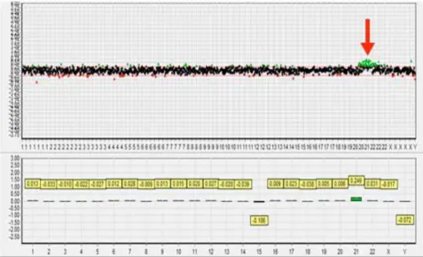 Figure 4.  Example of array comparative genomic hybridization based preimplantation genetic diagnosis result  from aneuploidy embryos with trisomy 21