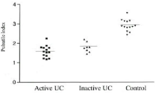 Fig. 4. The pulsatile index. Pulsatile index was significantly lower in patients with active and inactive UC than in control (1.58±