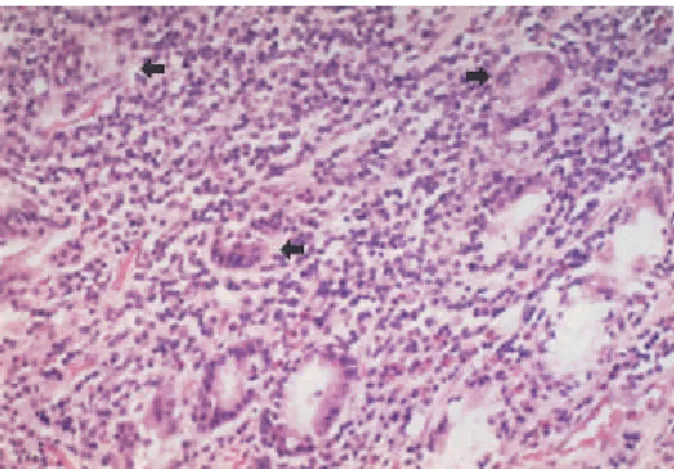 Fig. 4. Microscopic finding of the total gastrectomy specimen.