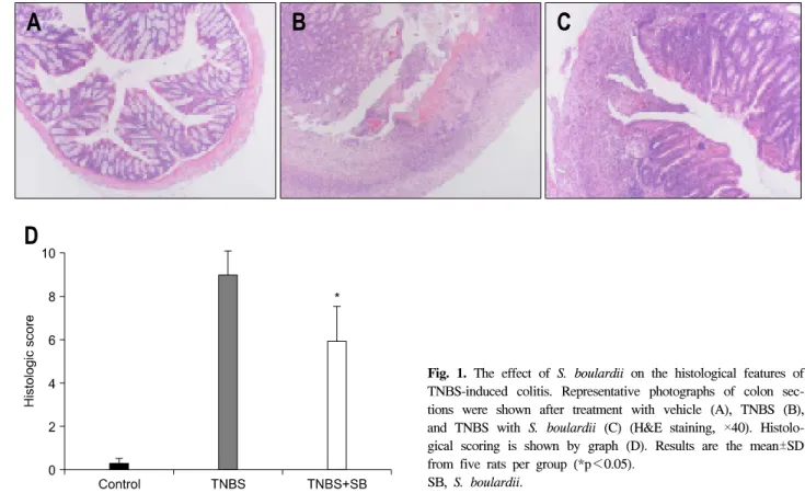 Fig.  1.  The  effect  of  S.  boulardii  on  the  histological  features  of  TNBS-induced  colitis